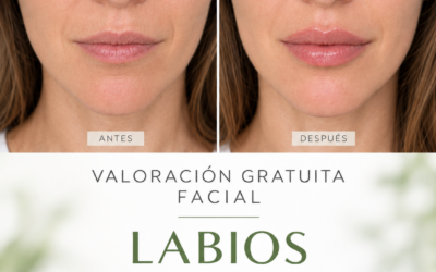 ¡Aumento de labios!
